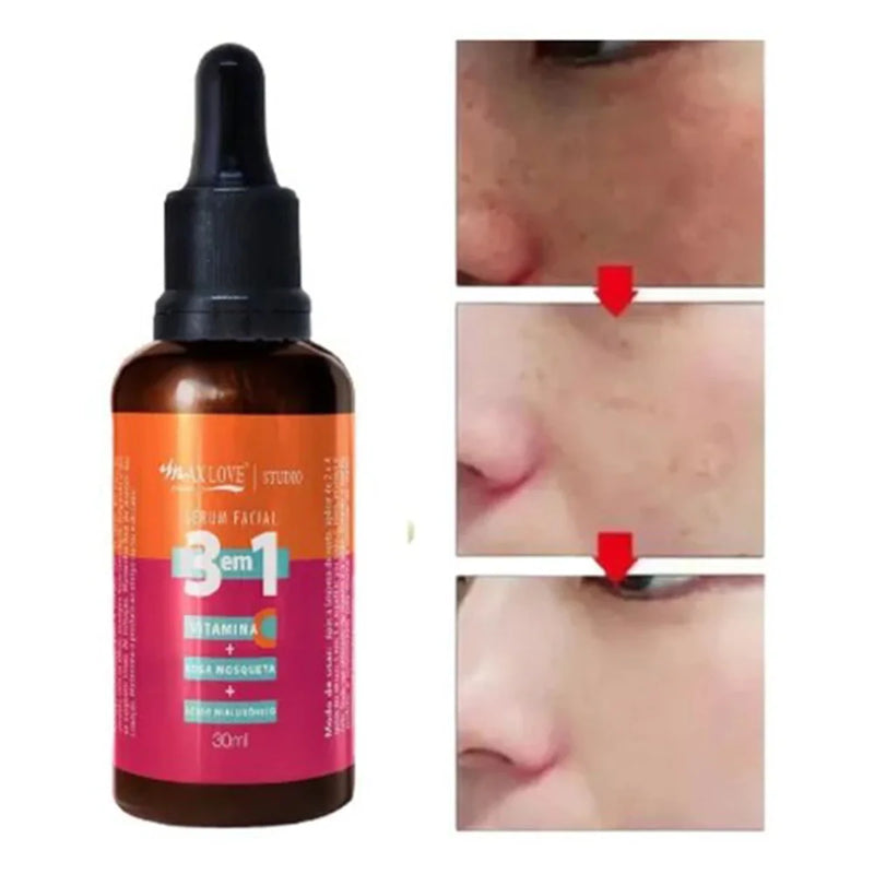 Sérum Facial Vitamina C 3 em 1 Ácido Hialurónico Rosa Mosquito 30ml - Max Love